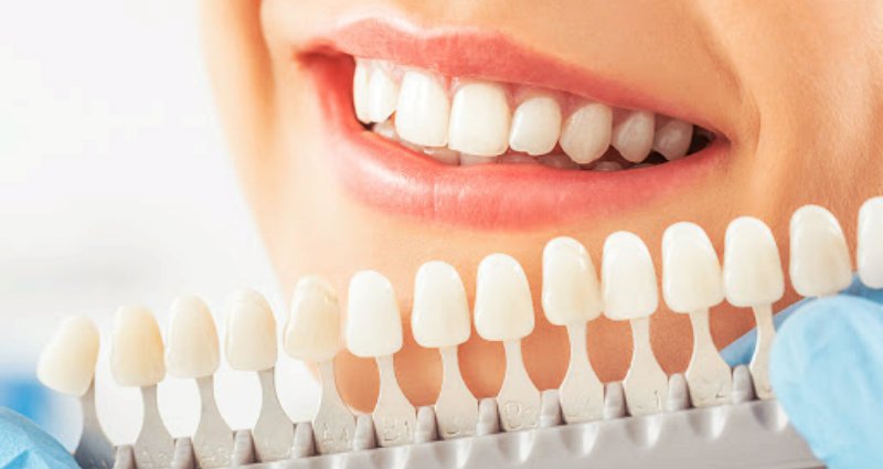 Cosmetic Dentistry